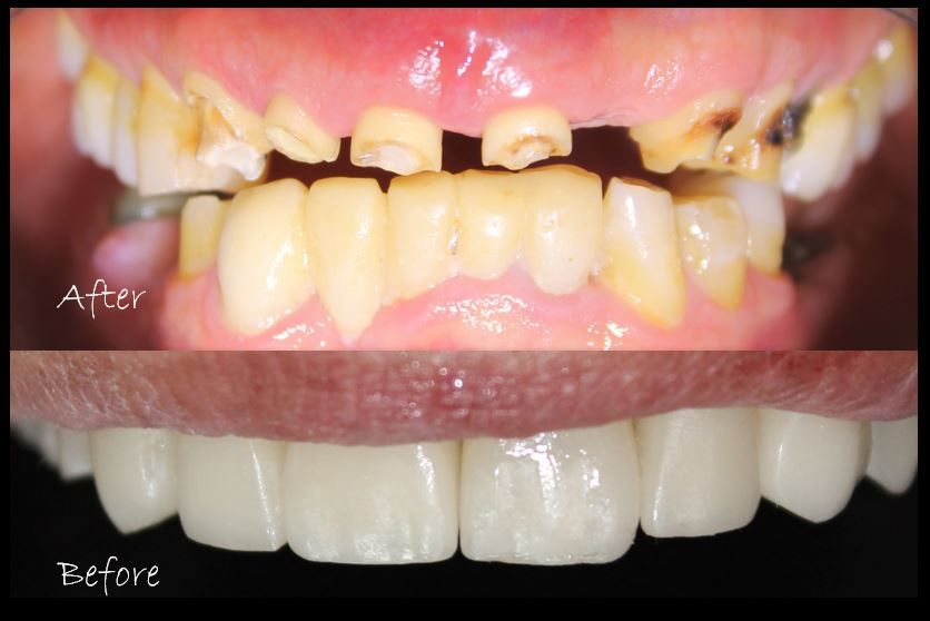 Aimee Valles Monárrez-27