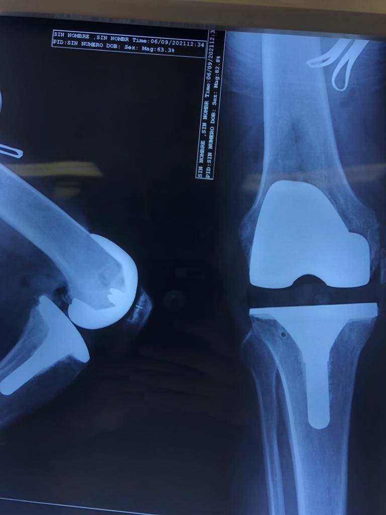 Aecio Madrigal Méndez-18