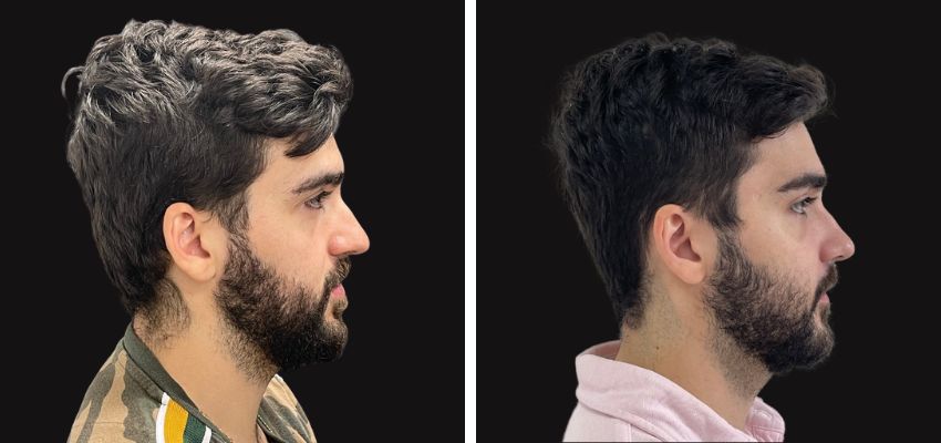 Federico Suastegui Carmona-10