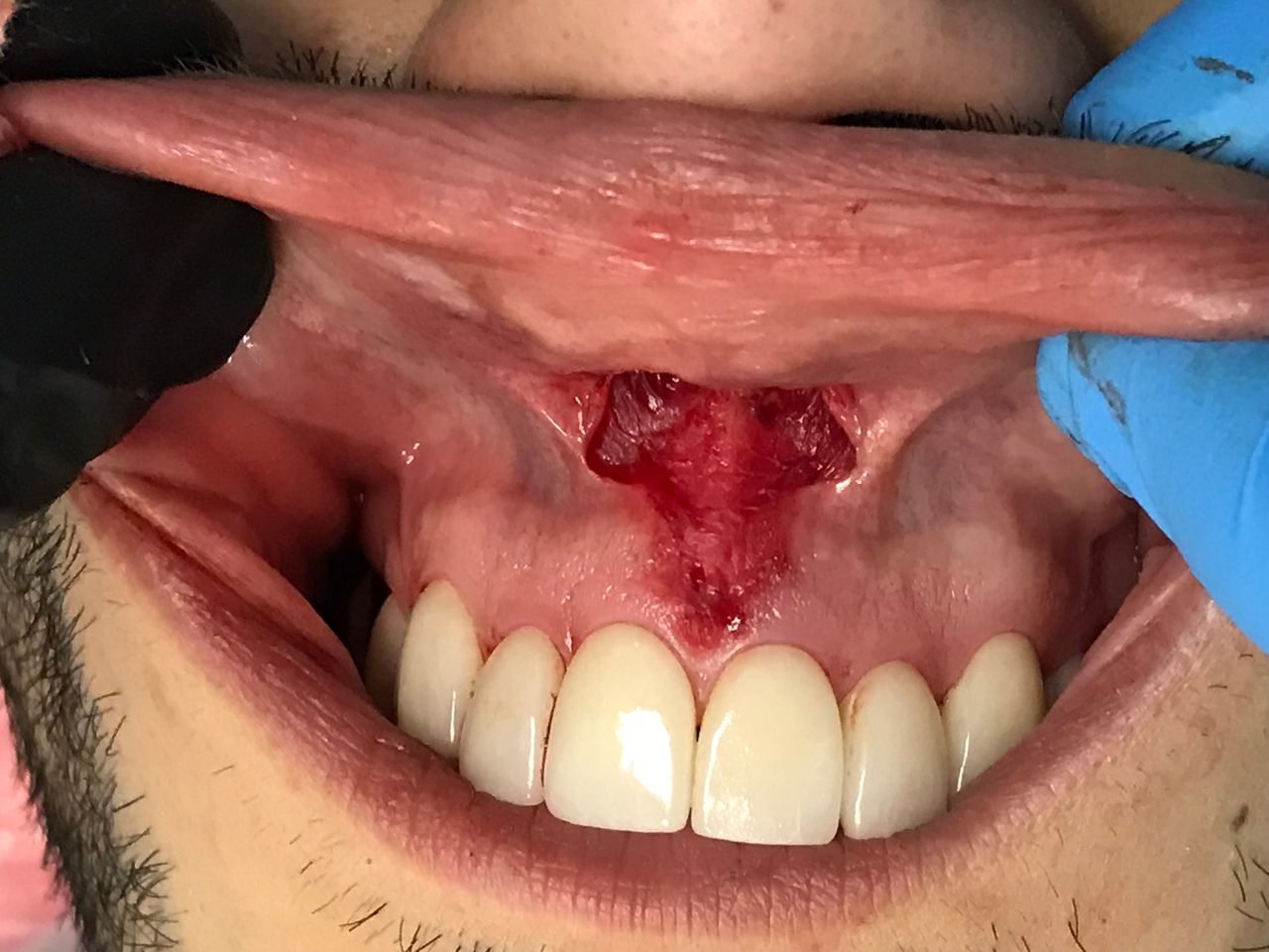 Alicia Araceli Navarro Burguete-29