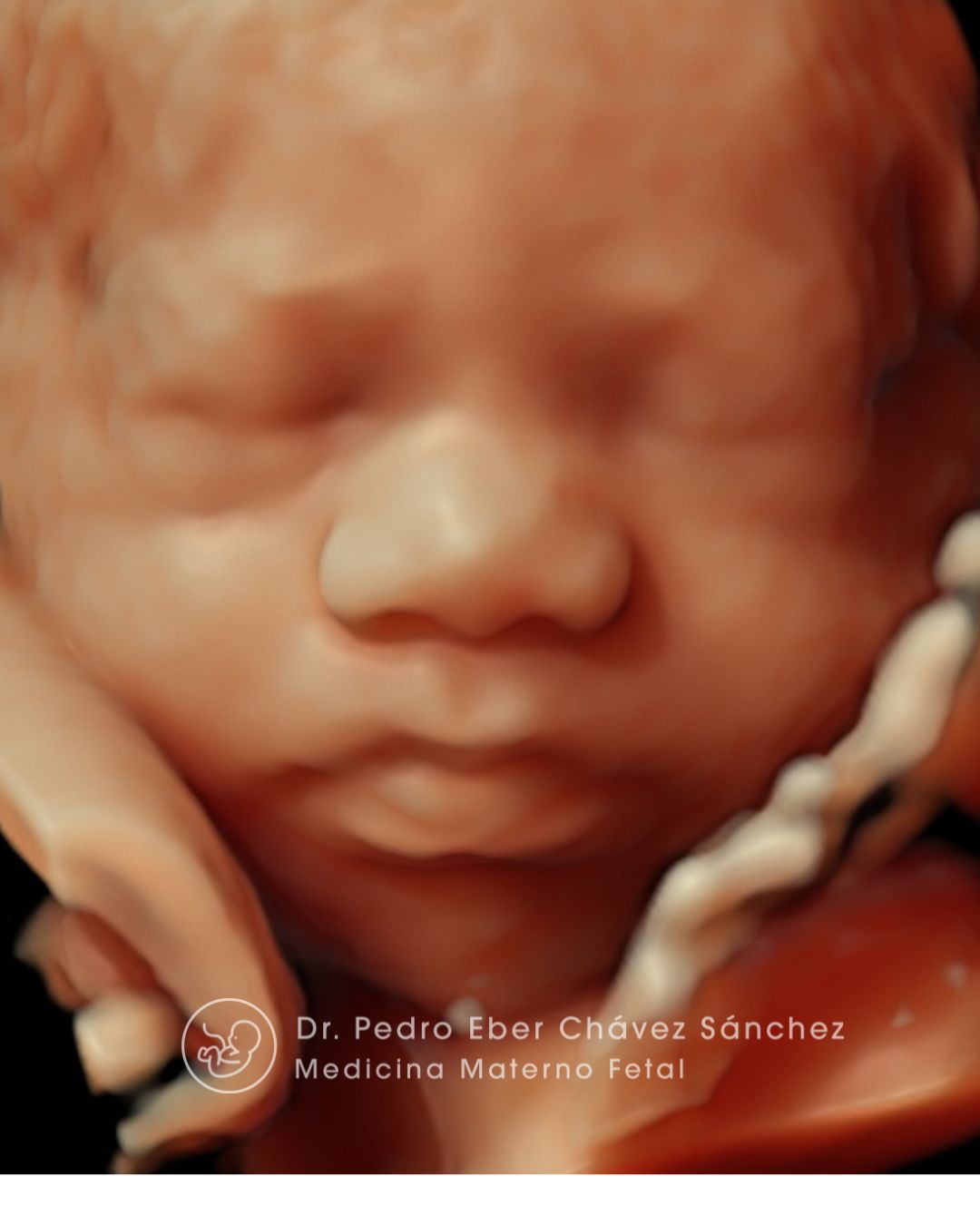 Pedro Eber Chávez Sánchez-1