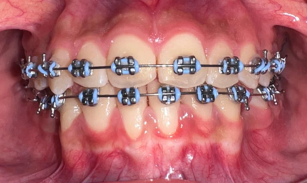 Arianny Stefani Urbaneja Noriega-2