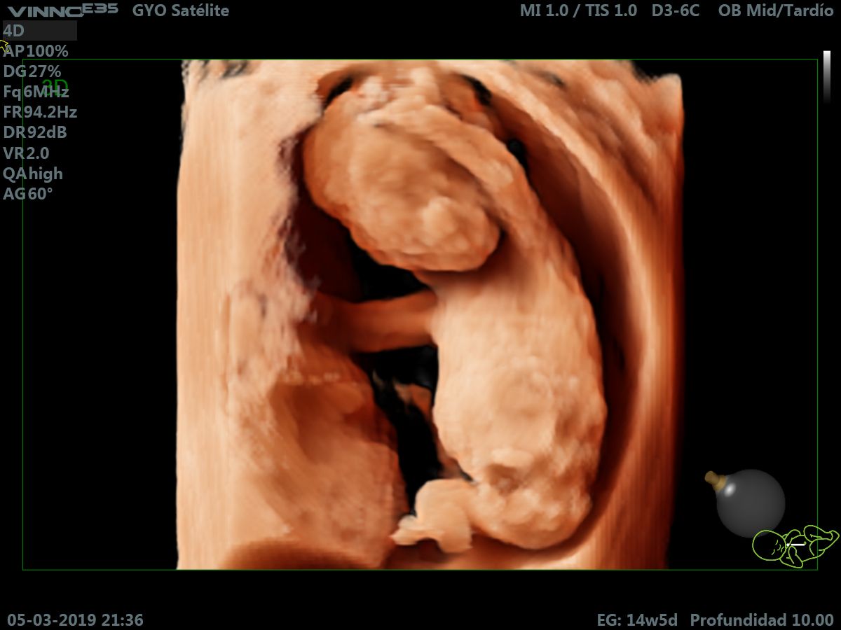 Giovanni Luis Tafelov Vindas-7