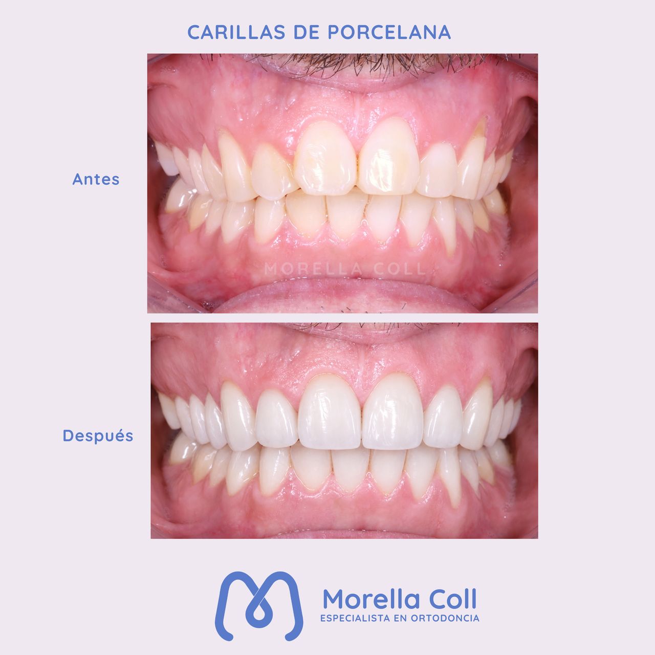 Morella Coll Mibelli-11