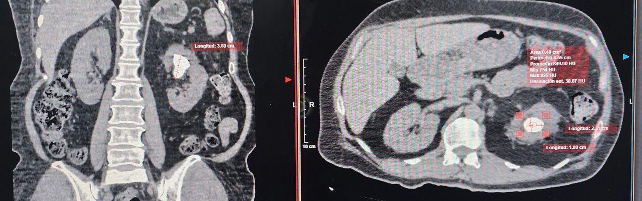 Lázaro Sánchez Vicuña-11