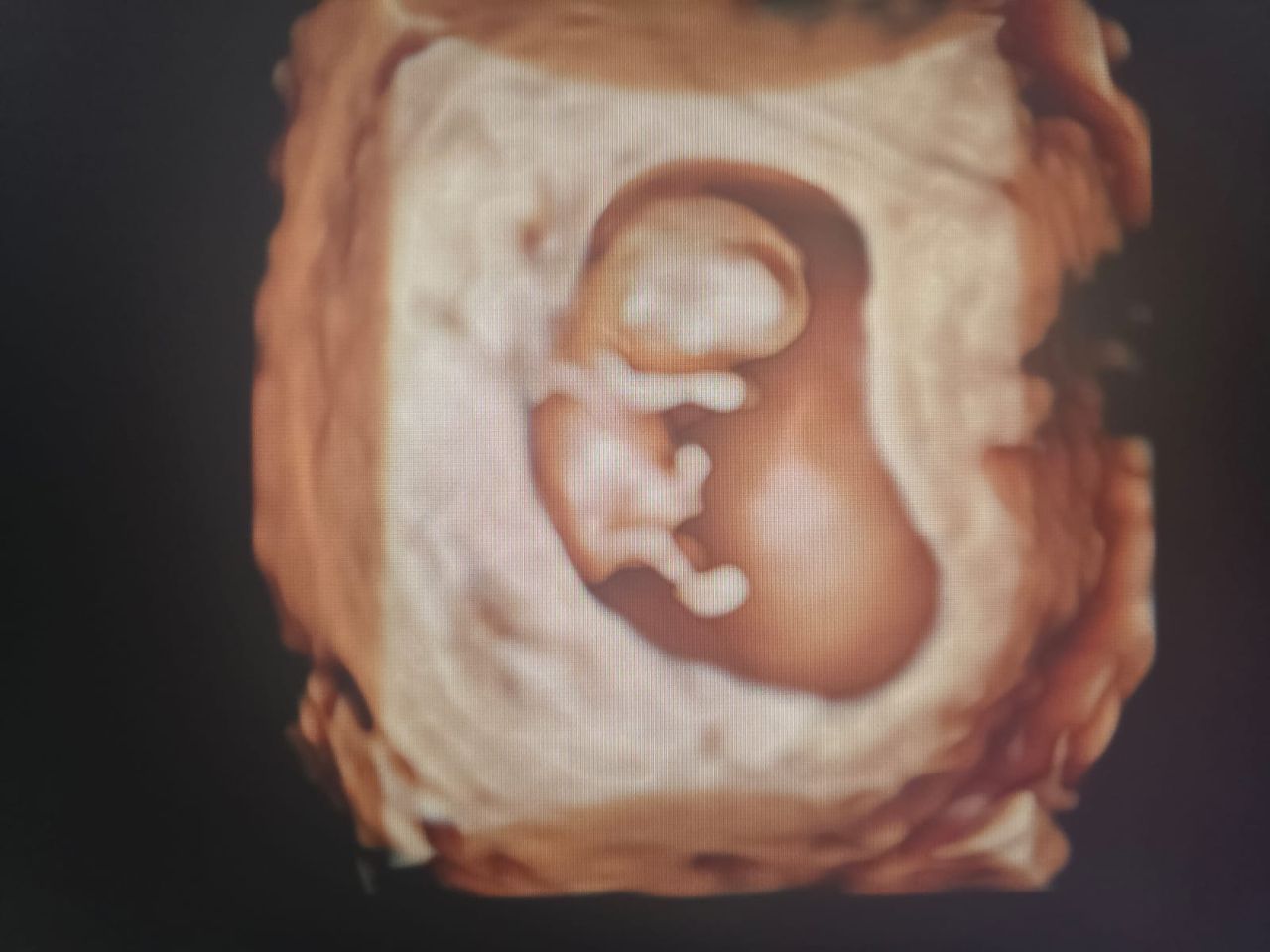 Abraham Ignacio Pérez De La Rosa-13