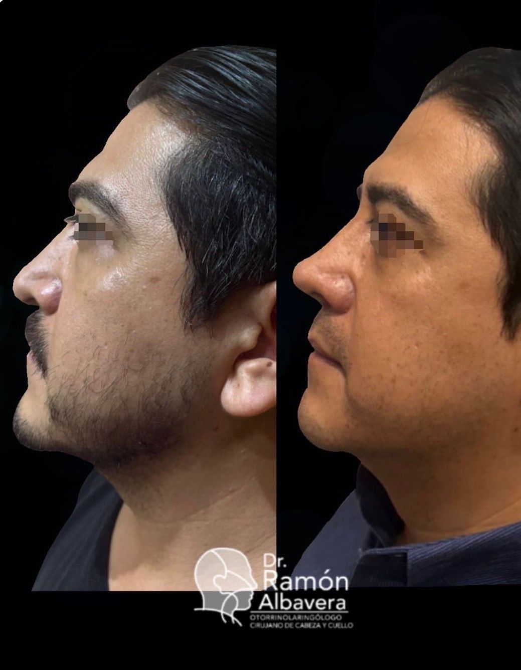 Luis Ramón Albavera Giles-3