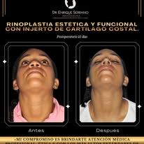 Enrique Serrano Cruz-3