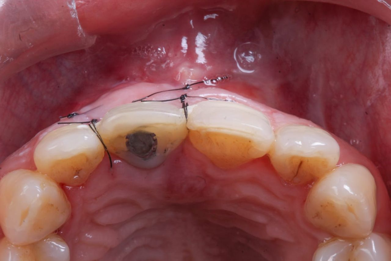 Hugo Enrique Aguilar Lamas-6