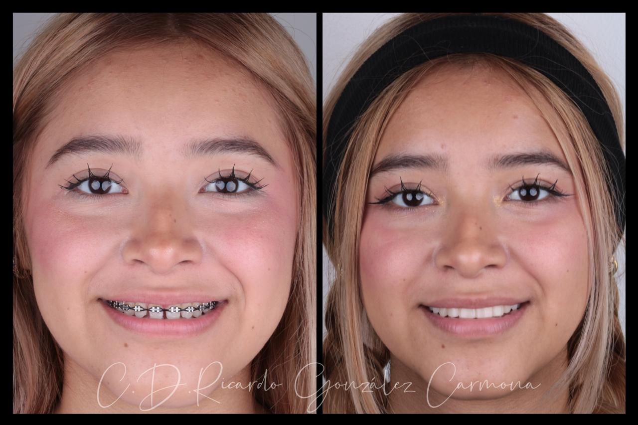 Ricardo González Carmona-1