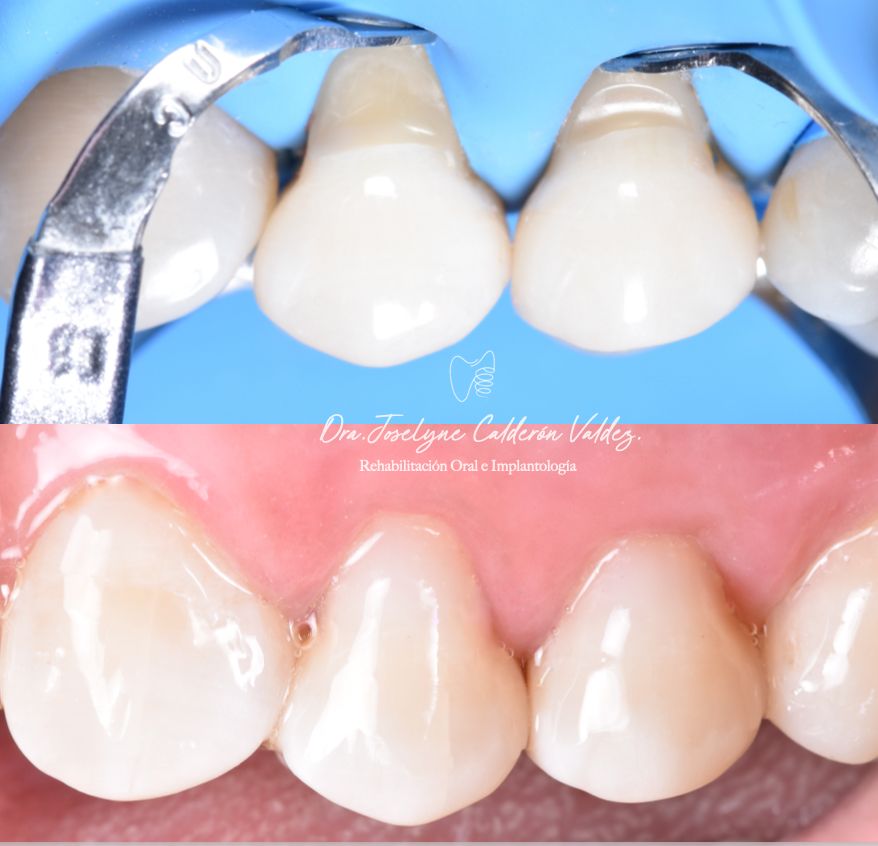 Joselyne Calderón Valdez-9