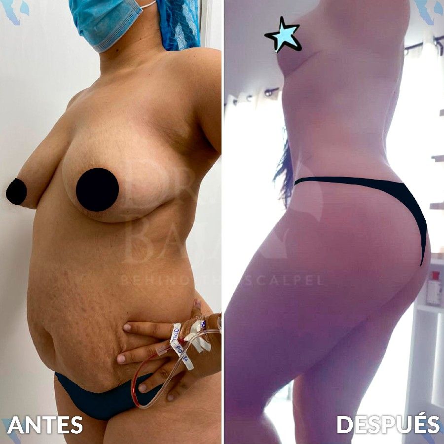 Renato Rodríguez Hirales-21