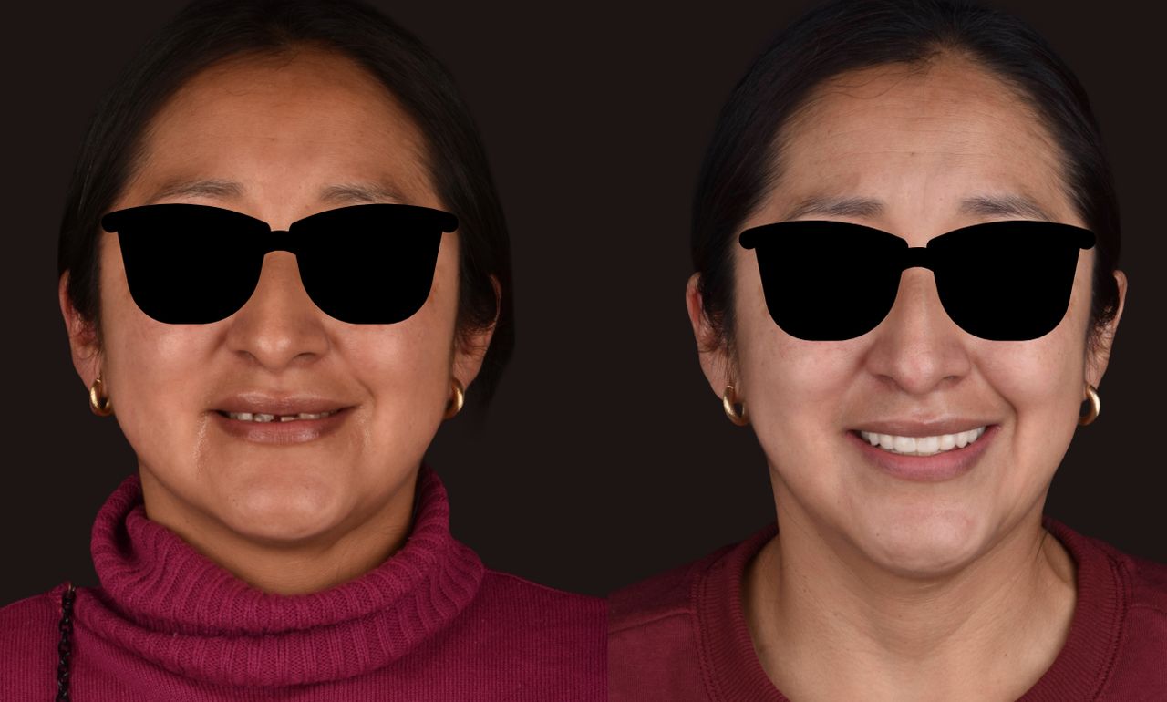 Lorena Manriquez Alonso-0