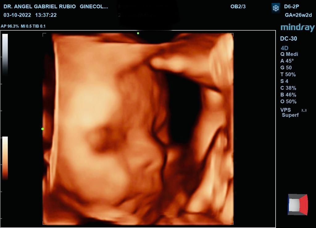 Ángel Gabriel Rubio Campos-8