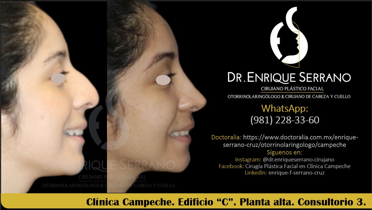 Enrique Serrano Cruz-79