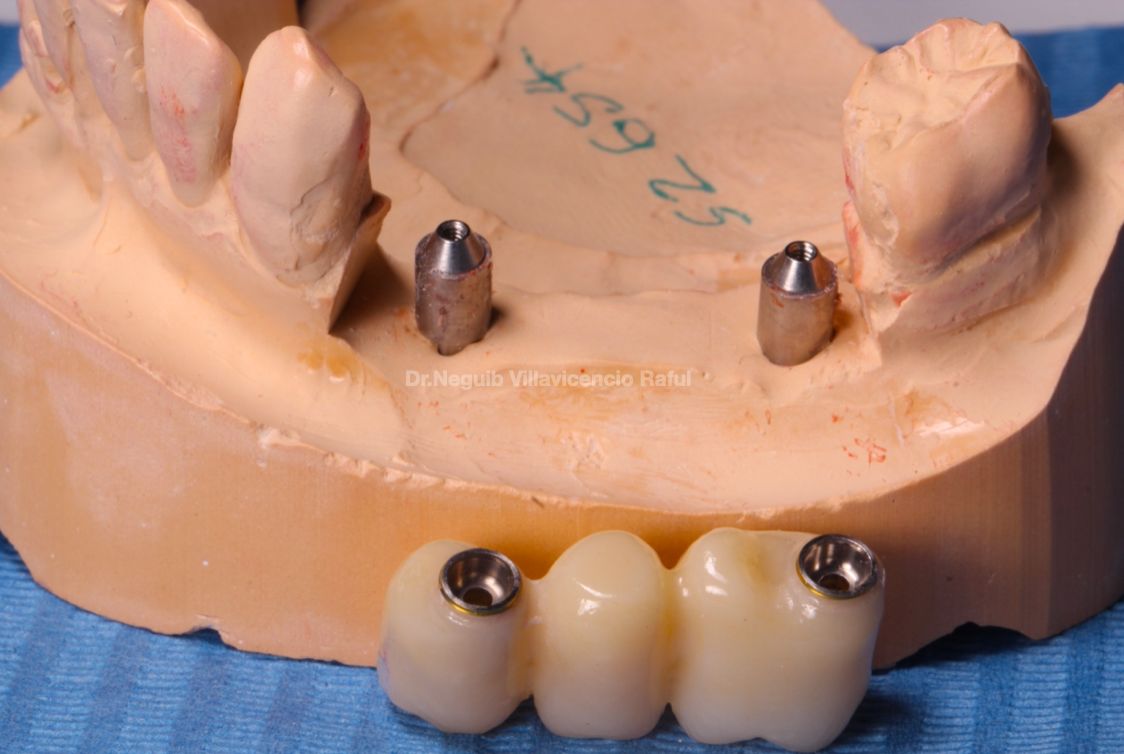 Neguib Villavicencio Raful-32