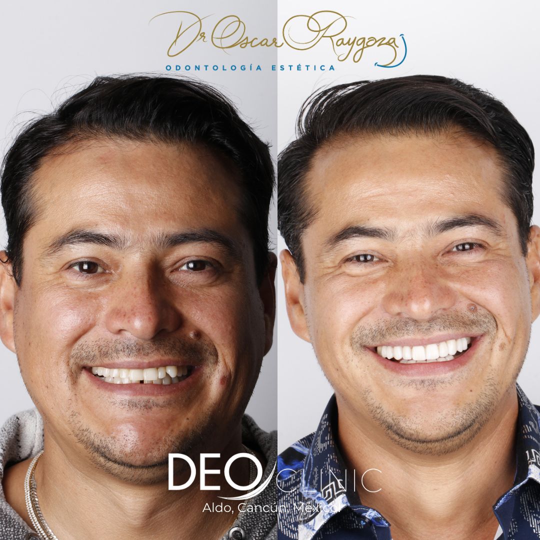 Oscar Raygoza Carrillo-41