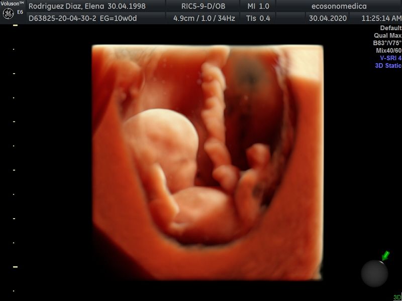 Héctor Bernardo Acevedo Manrique-9