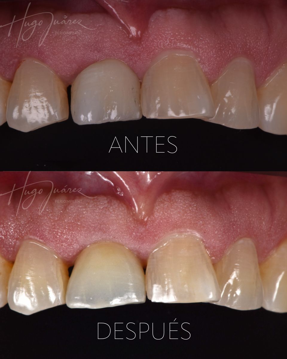 Hugo Juárez César-9