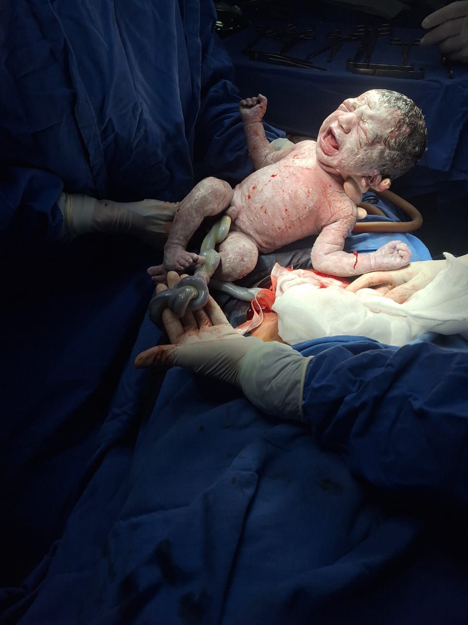 Elibel Perez Vargas-2