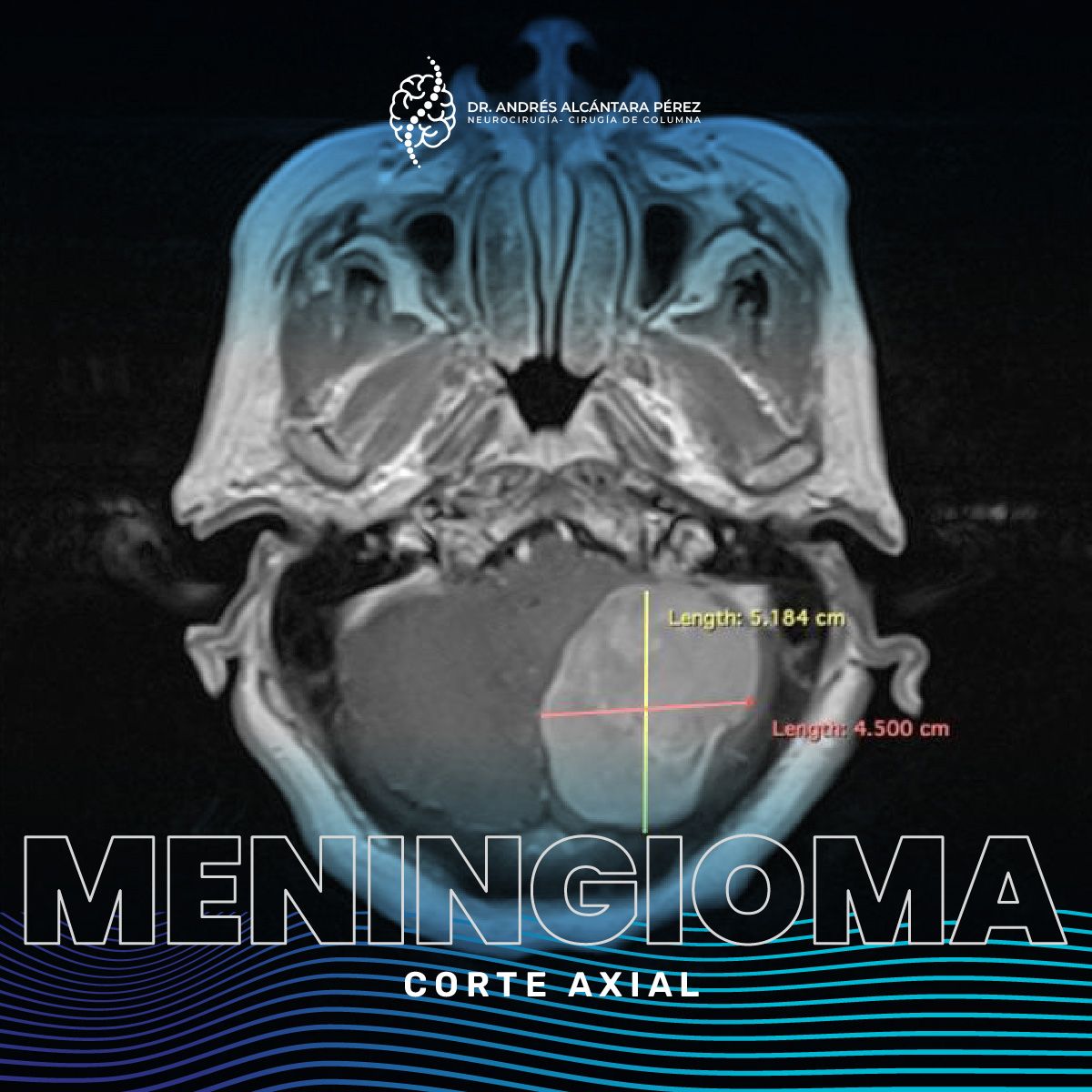 Andres Alcántara Pérez-16