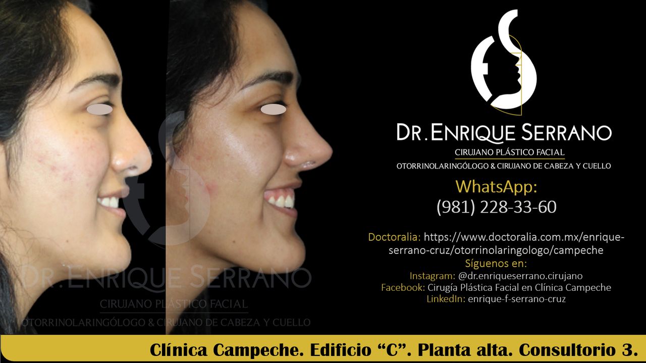 Enrique Serrano Cruz-61