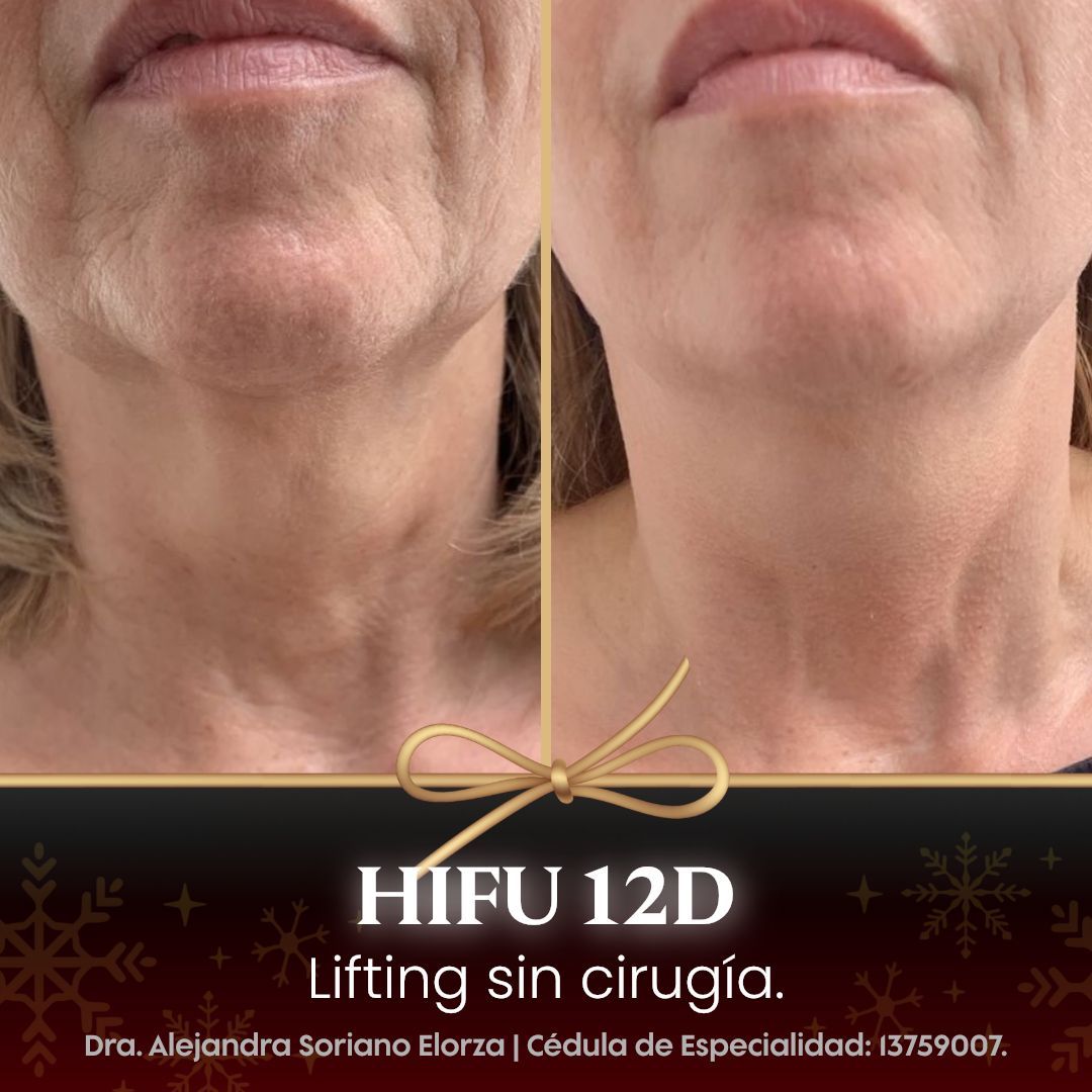 Alejandra Soriano Elorza-81