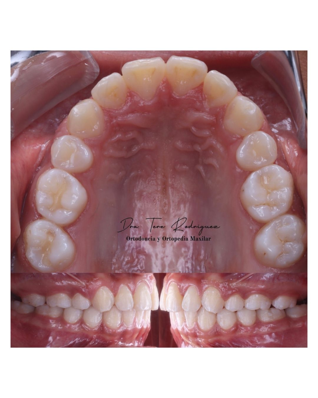 Teresa Rodriguez Candia-2