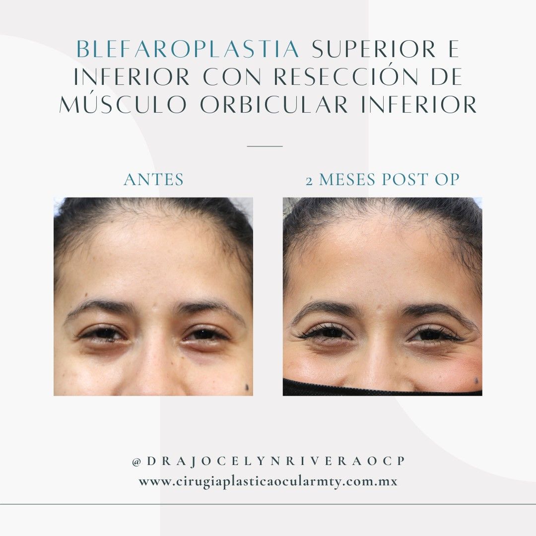 Ivonne Jocelyn Rivera Alvarado-4