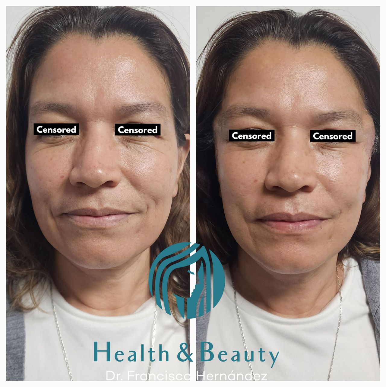 Francisco Hernández Gómez Crespo-69