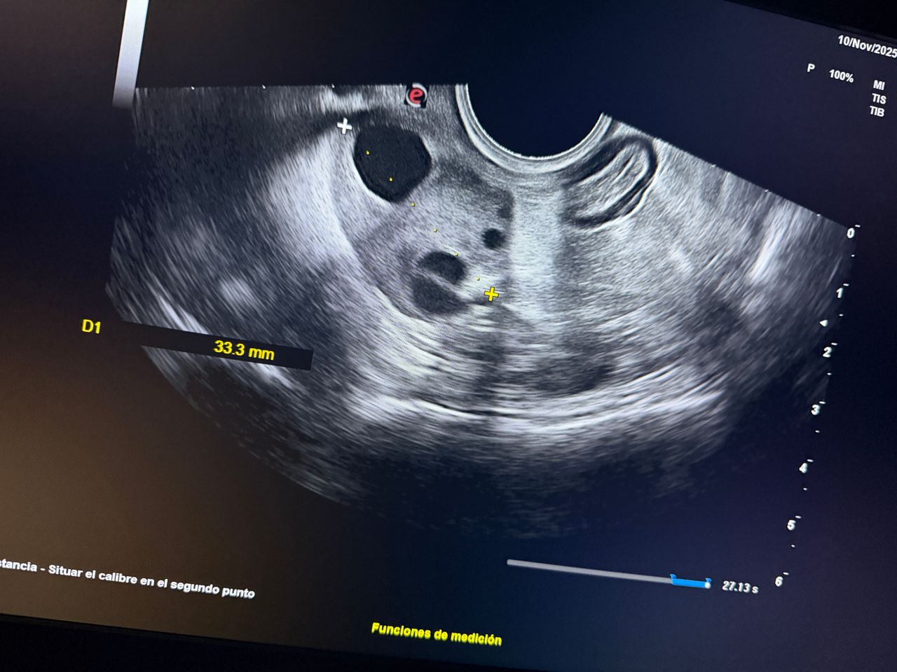 Christian Samuel Uitzil Colli-3