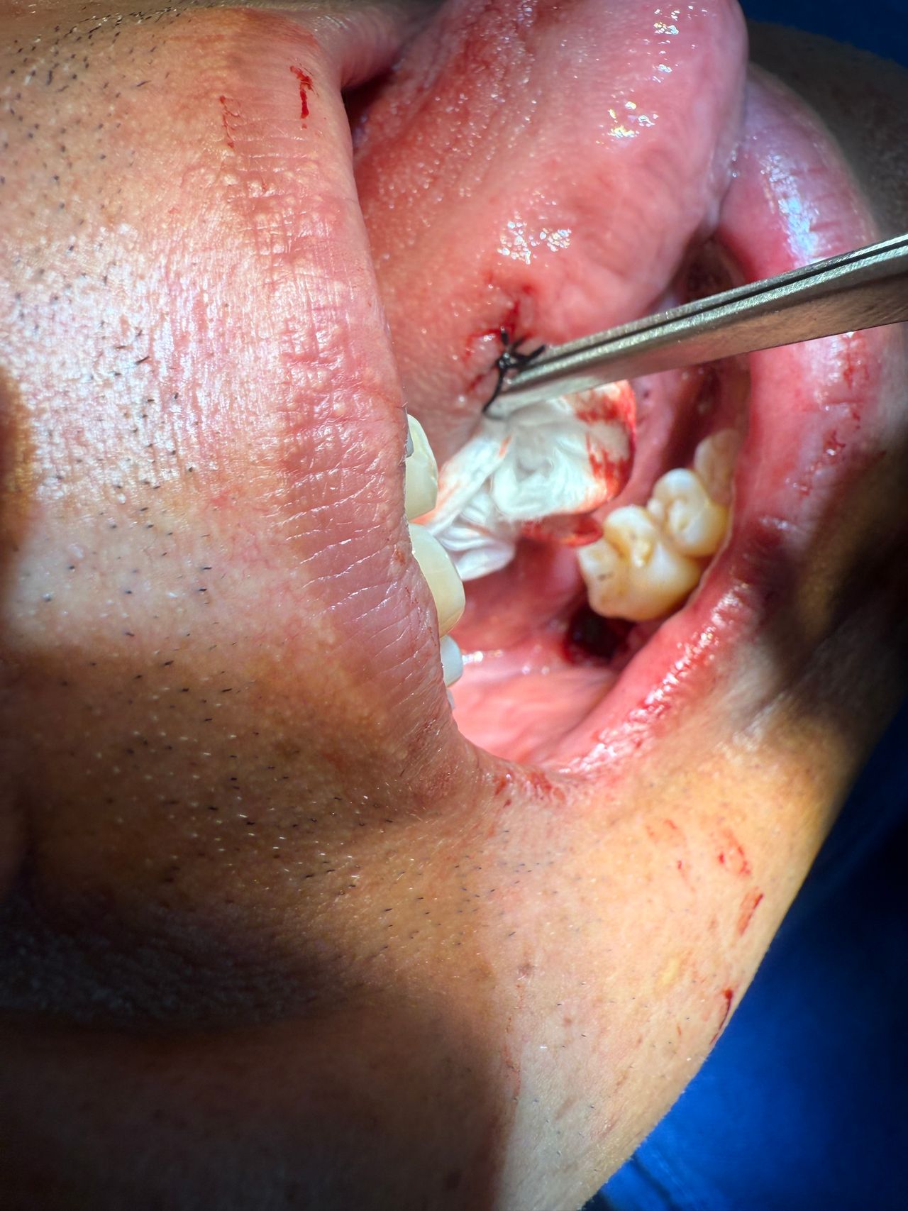 Eduardo López Méndez-39