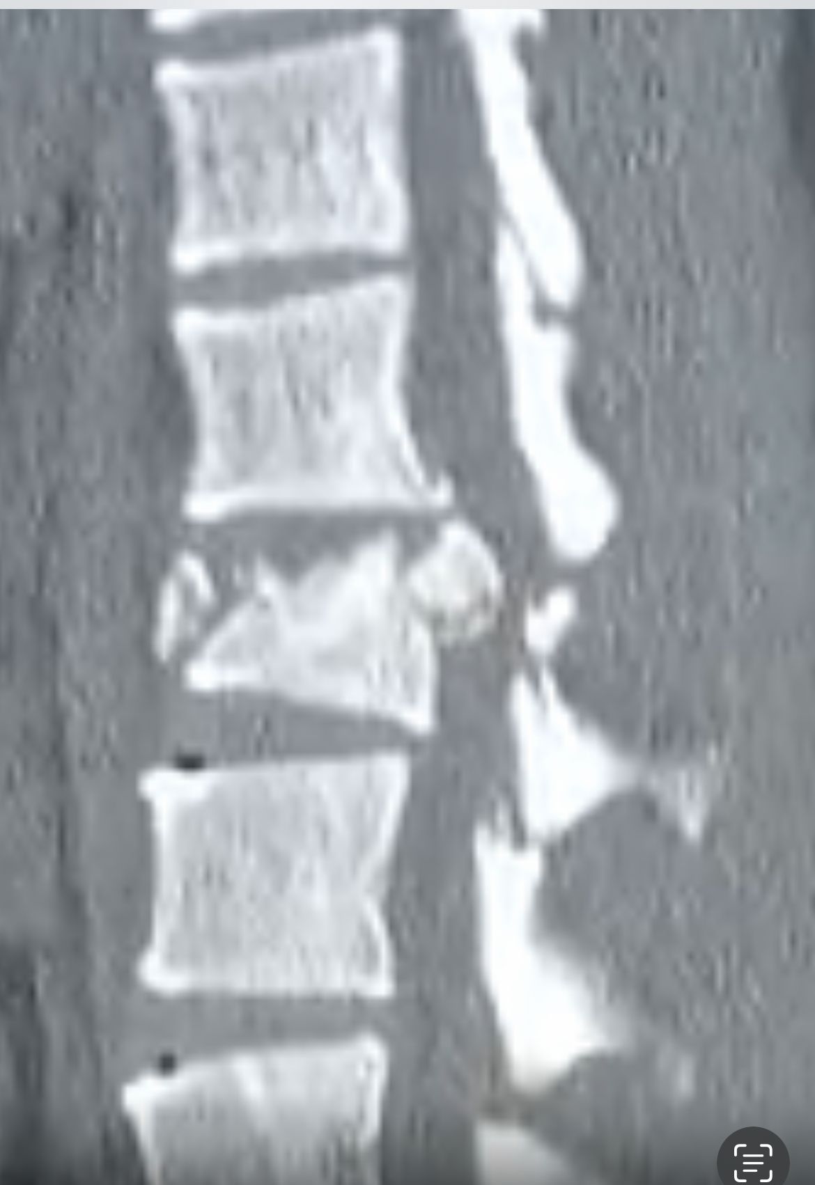 Emmanuel Bolaños Cortes-0