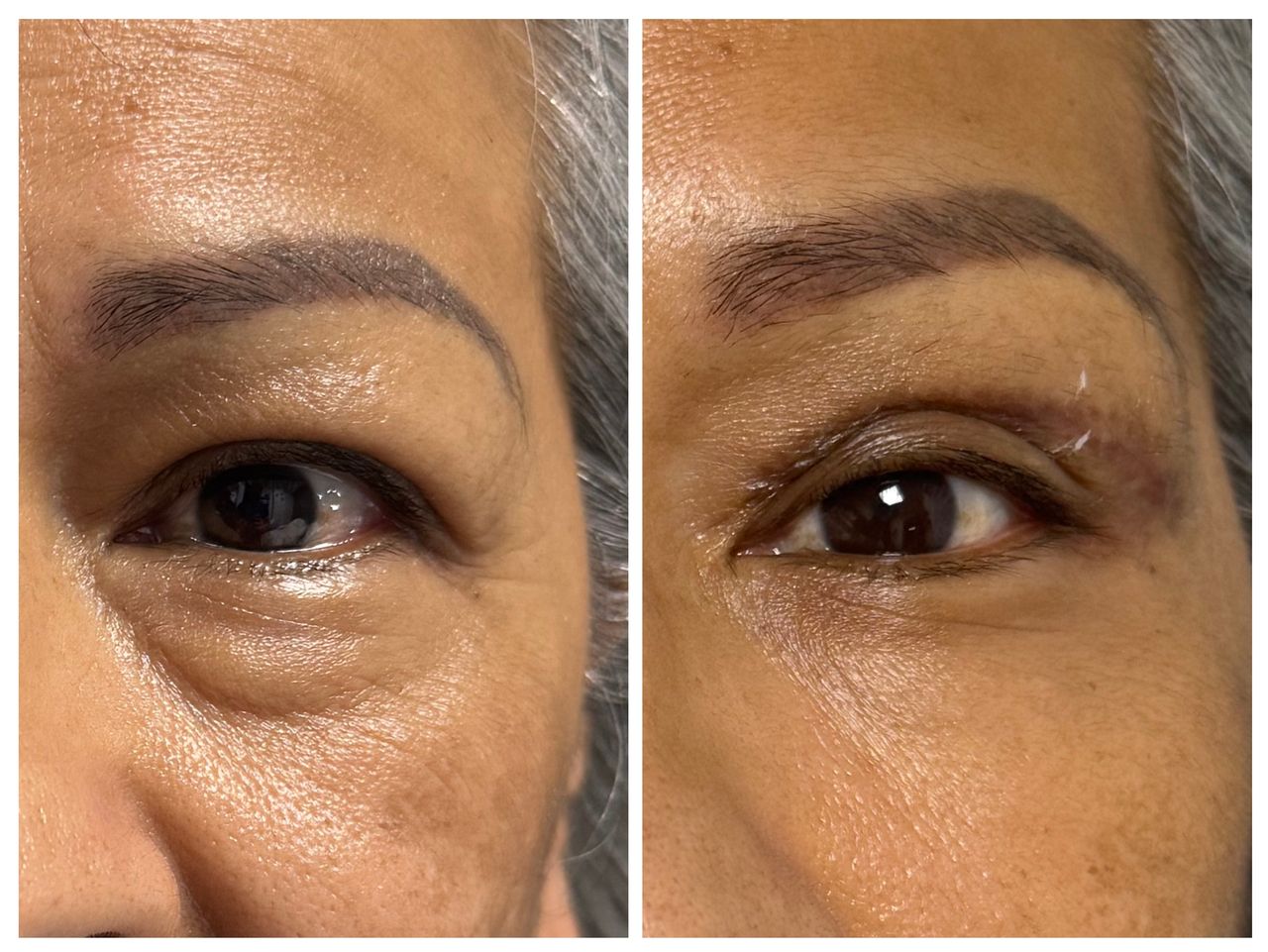 Ismael Tapia Castro-5