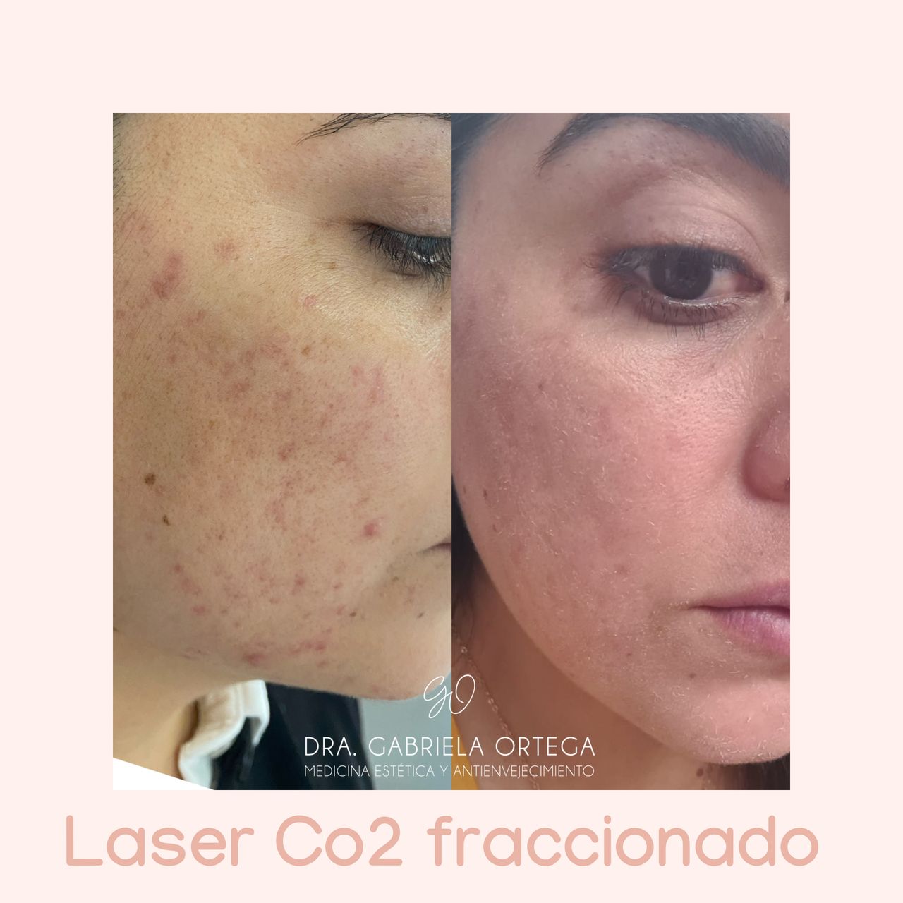 Gabriela Ortega Avila-5