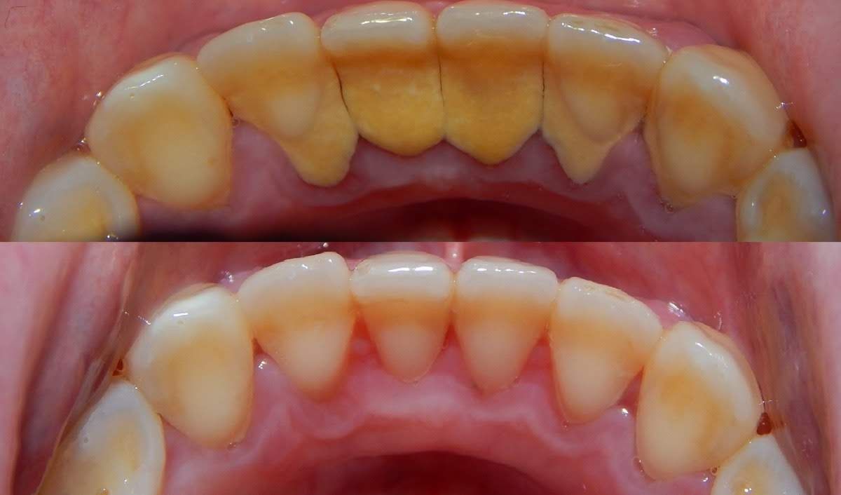 Juan Ricardo López Castillo-6