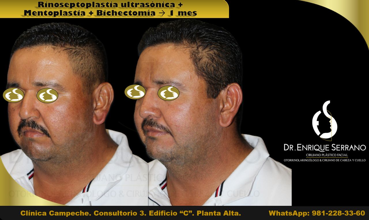 Enrique Serrano Cruz-27