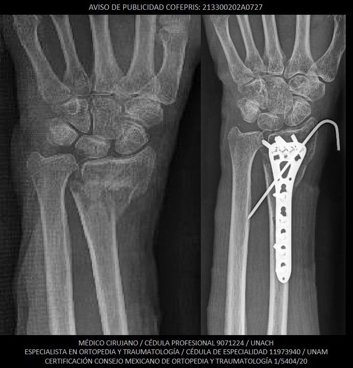 Luis Castañón Robles-19