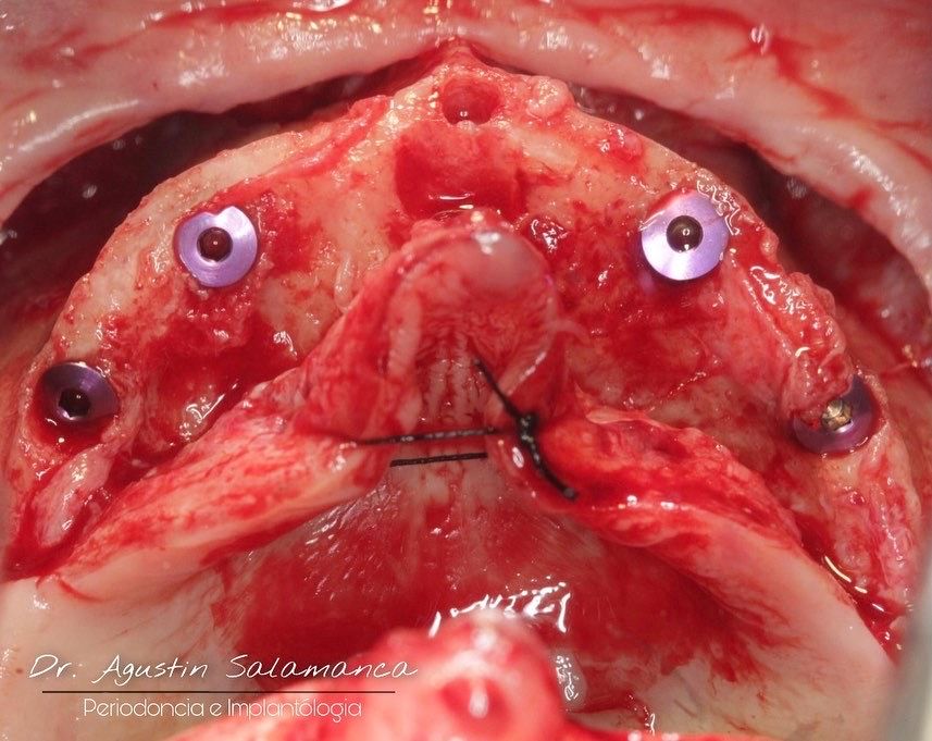 Agustin Salamanca Tapia-22