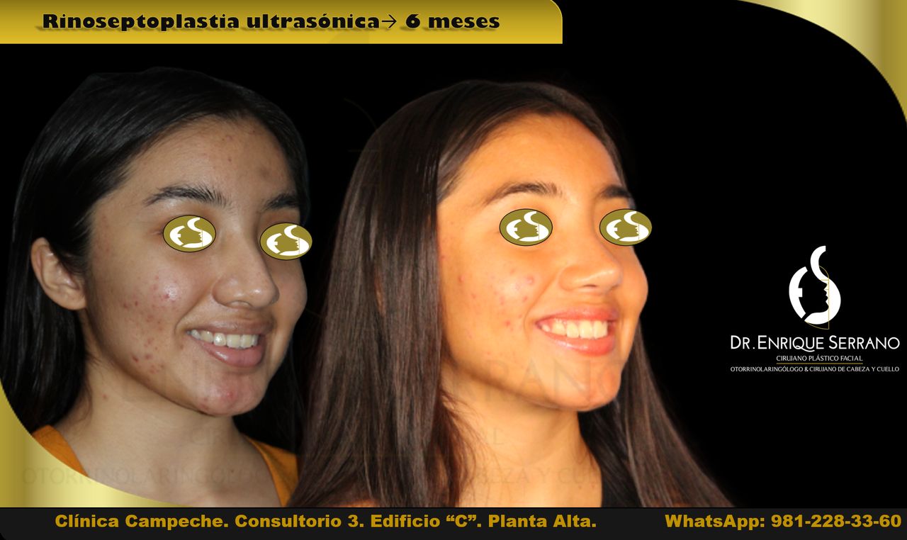 Enrique Serrano Cruz-31