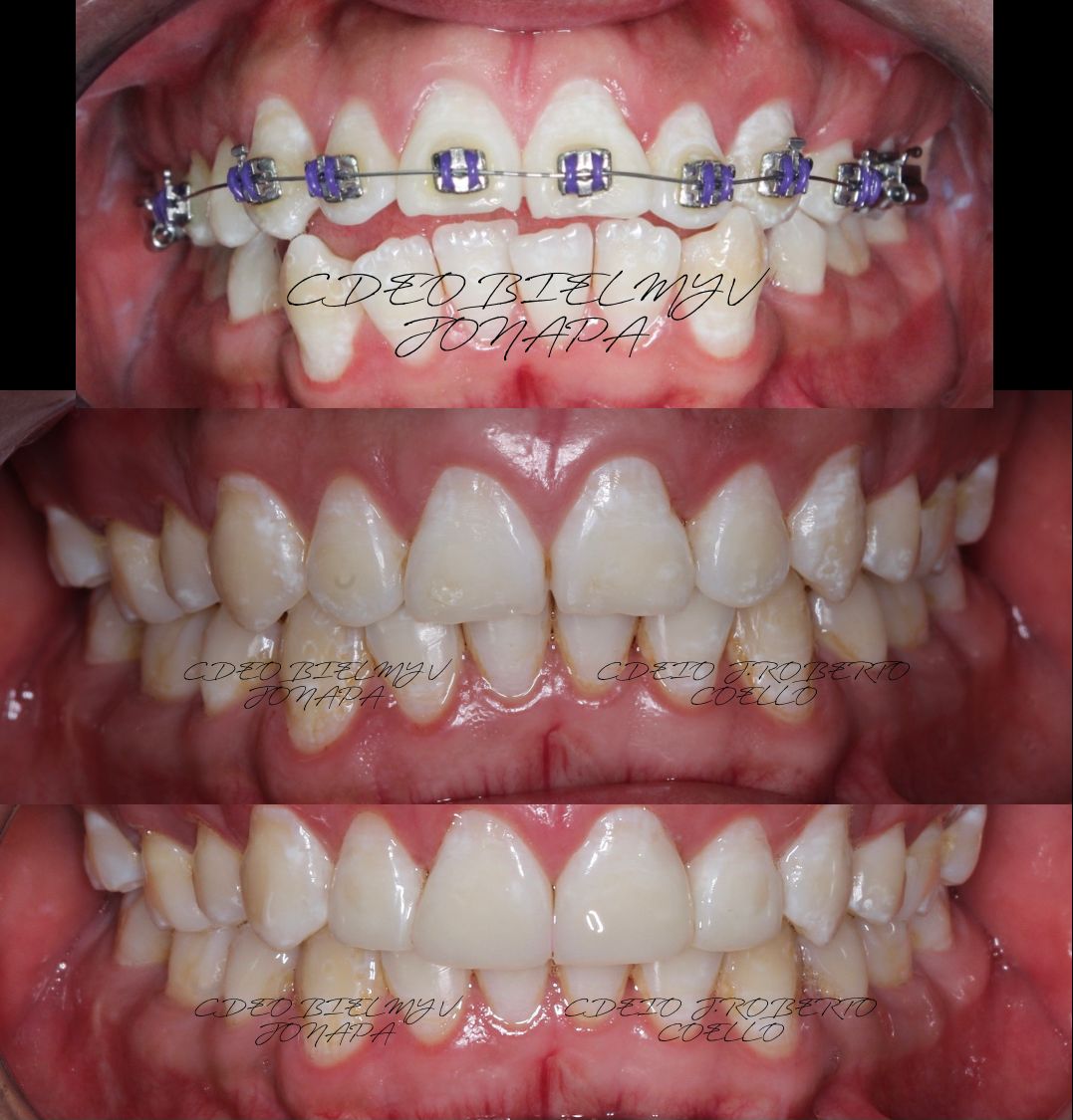 Bielmy Veronica Jonapa Peña-4