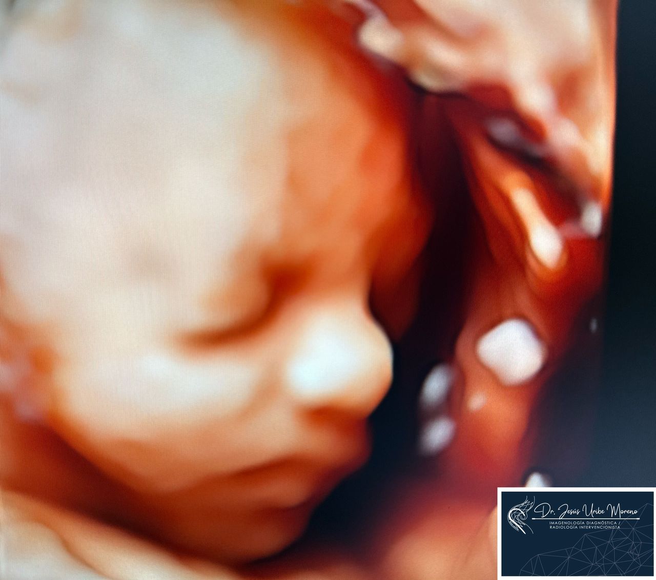 Jesus Uribe Moreno-3