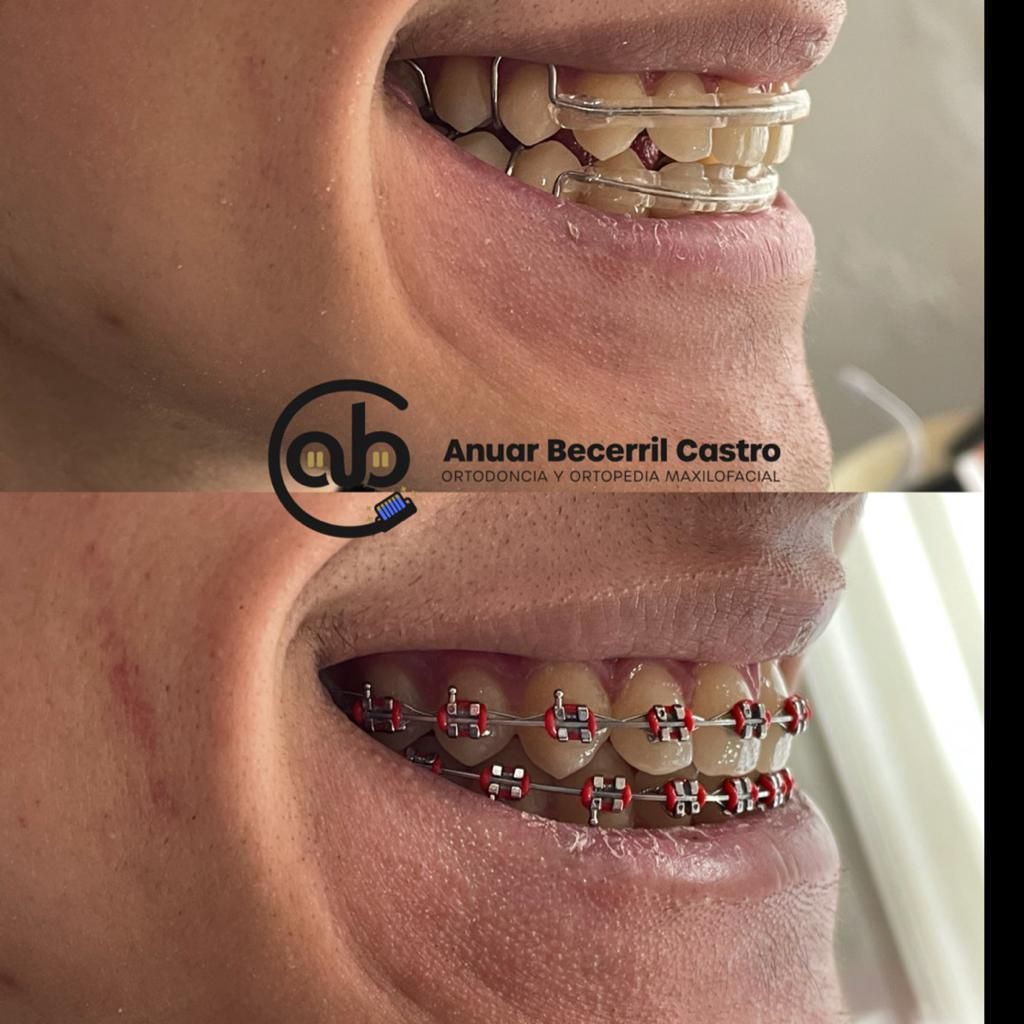 Anuar Becerril Castro-27