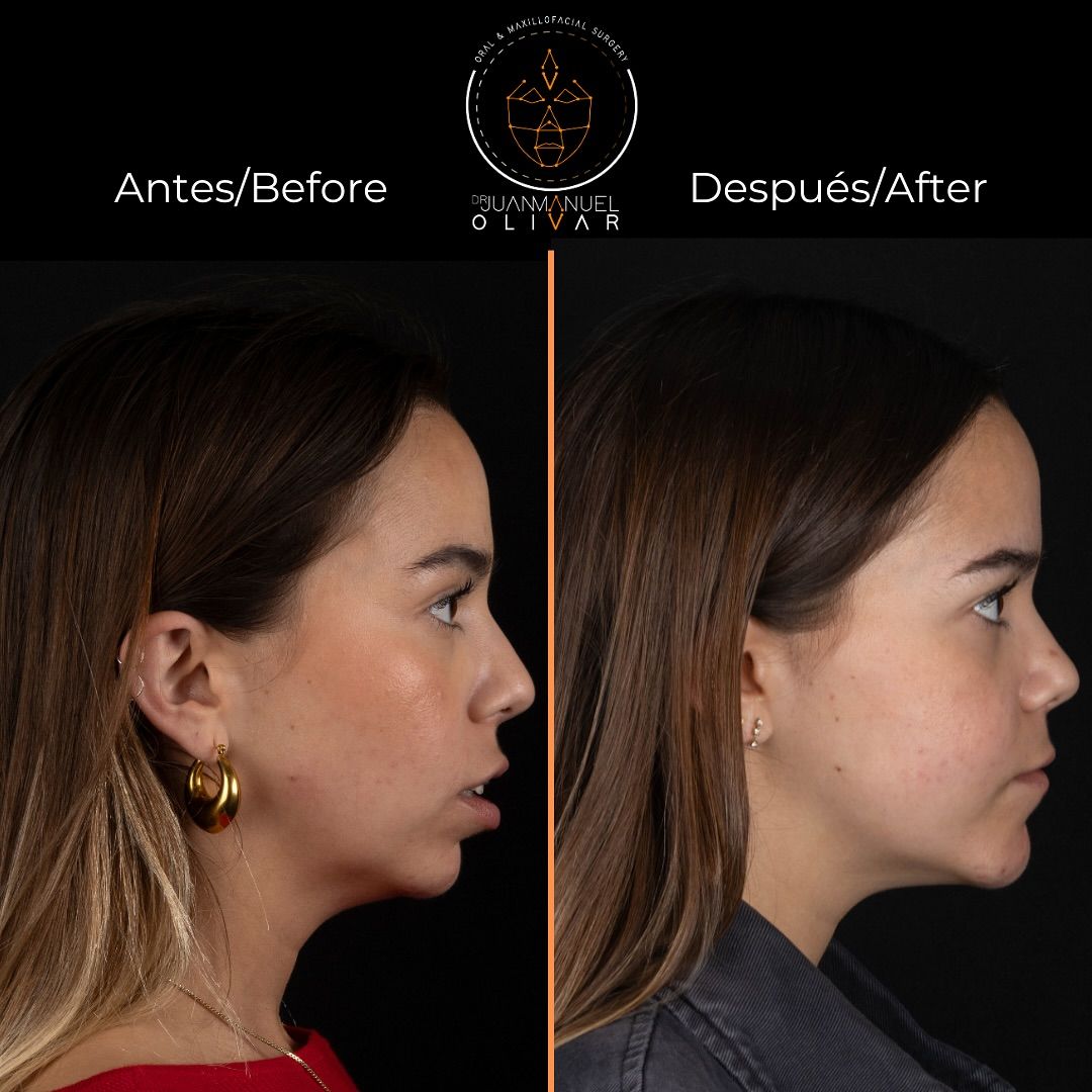 Juan Manuel Olivar Cedeño-7