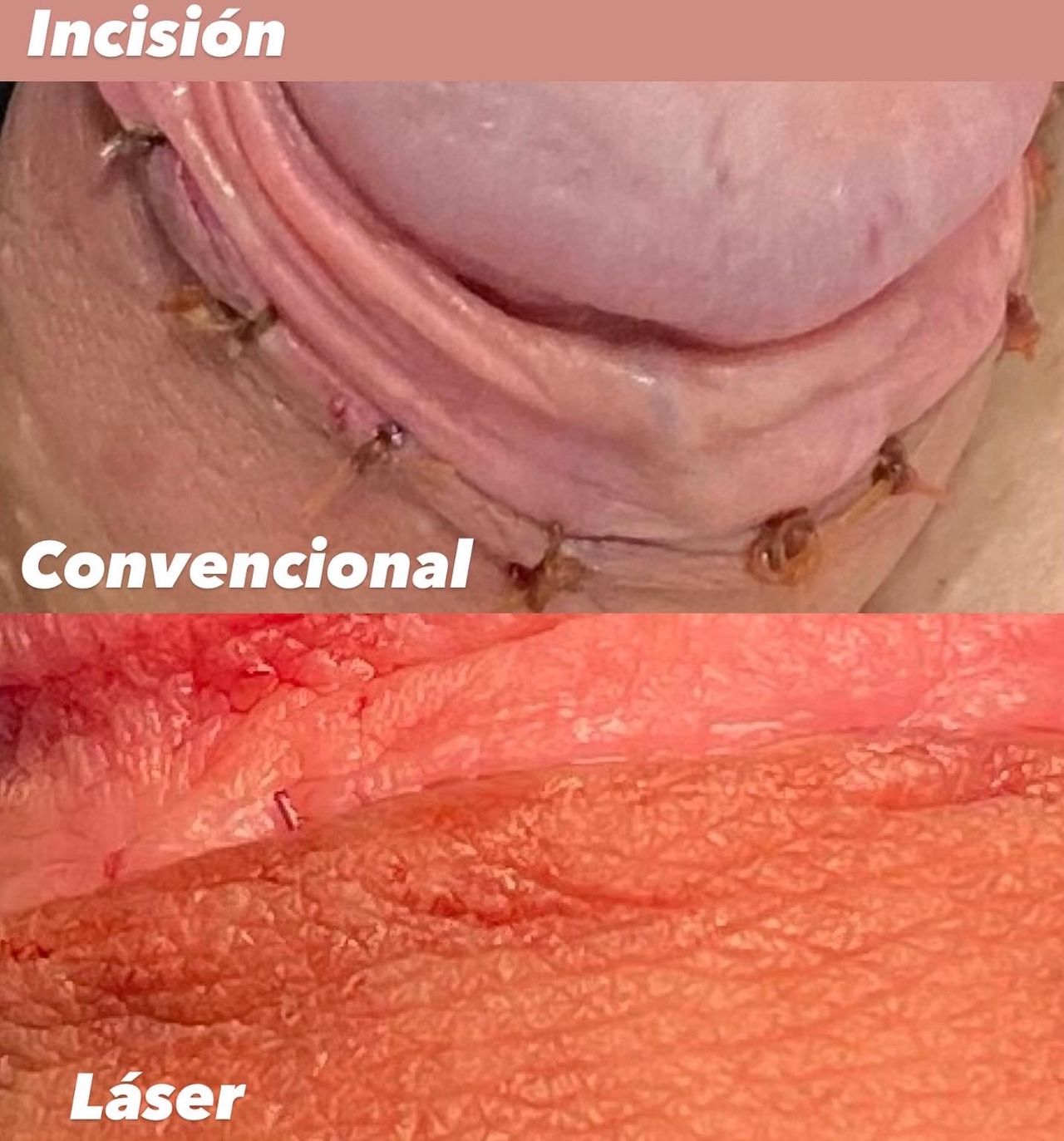 Miguel Angel Hernández Beltrán-3