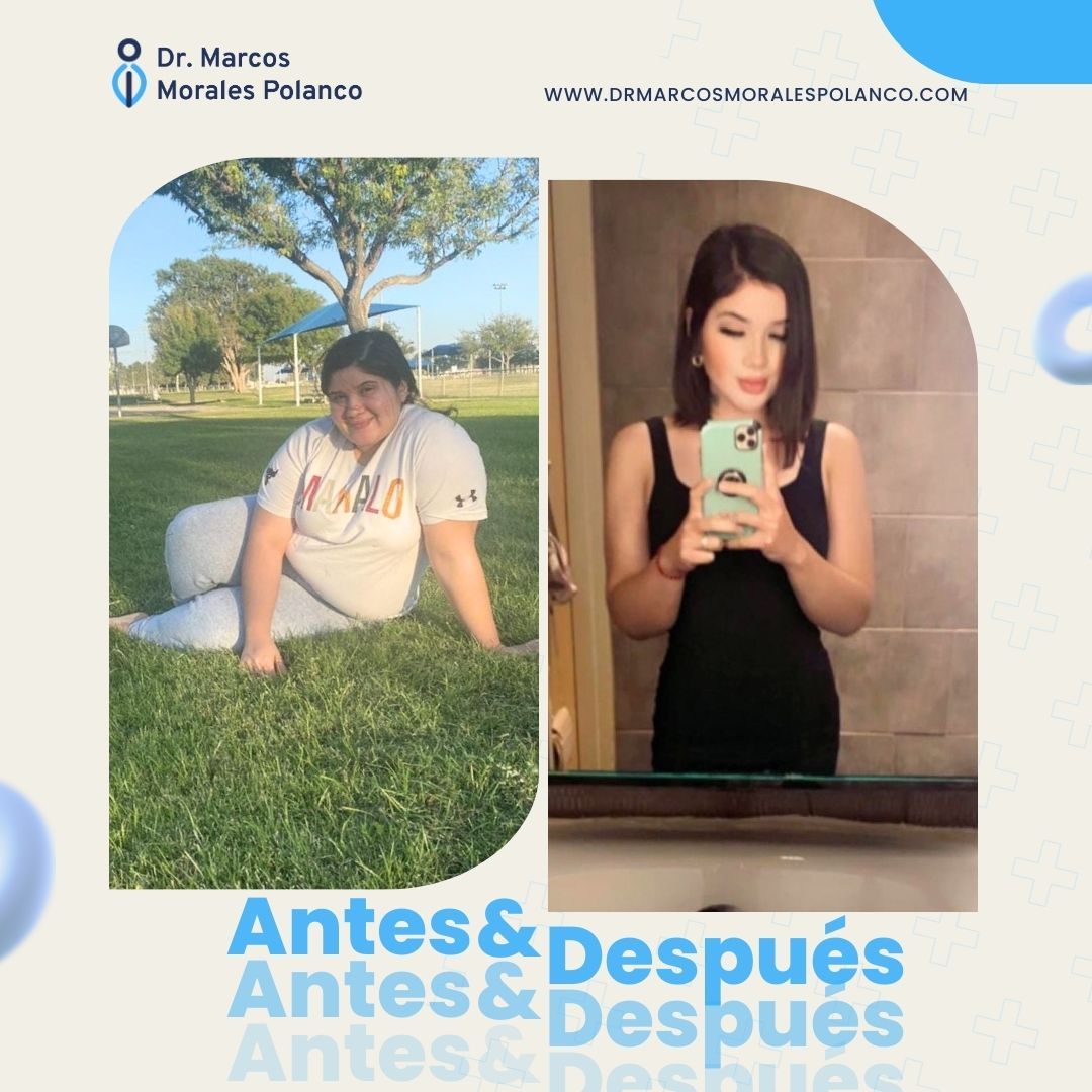 Marcos Morales Polanco-5