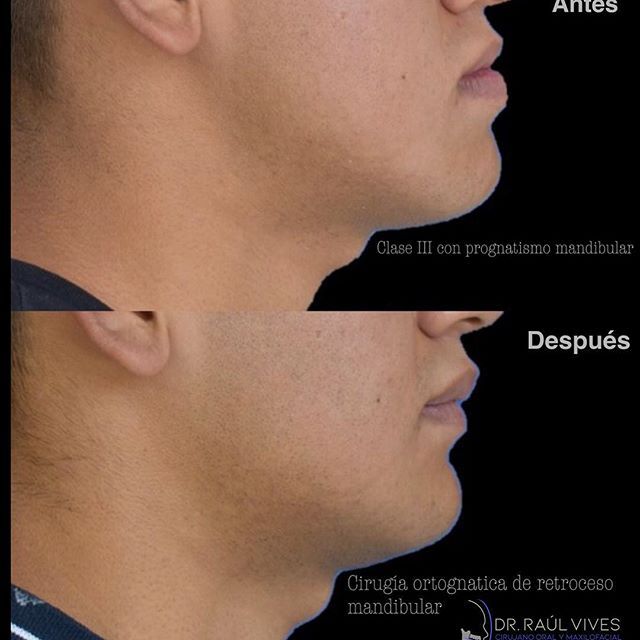 Raúl José Vives Serrano-3