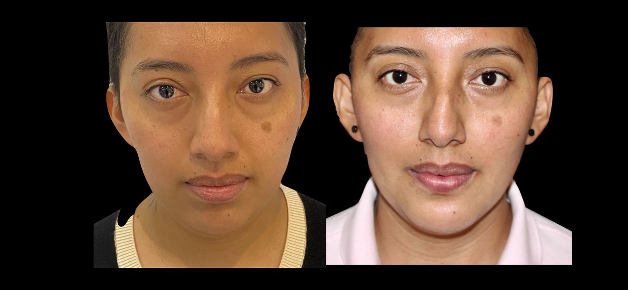 Giovani Ramírez Limón-10