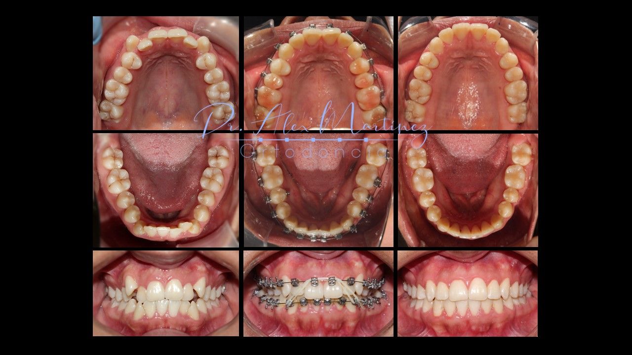 Alejandro Martínez Hernández-6