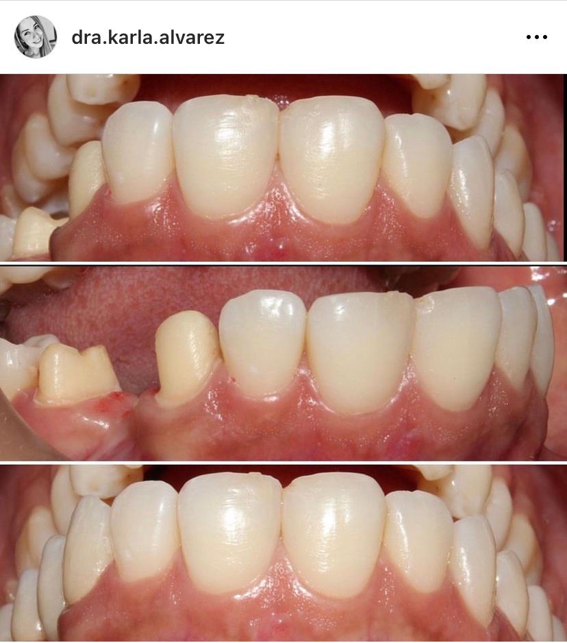 Karla Alvarez Treviño-16